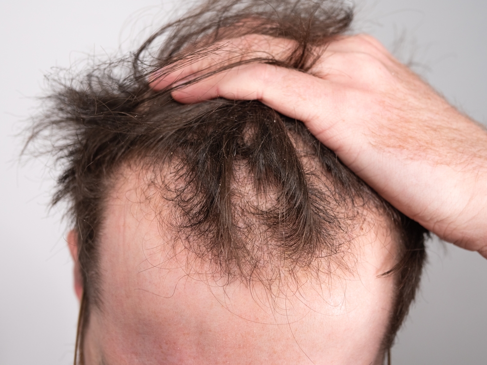 Close,Up,Of,A,Young,Man,Holding,His,Hair,Back